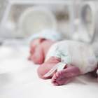 Nato il bimbo prematuro più piccolo al mondo: ecco quanto pesava alla nascita