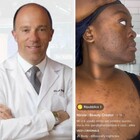 Iperpigmentazione: cos'è e quali sono i rimedi. L'intervista al dermatologo Andrea Paro Vidolin