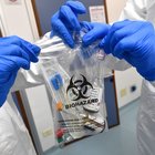 Quattro casi italiani durante la Sars e due di ebola: tutti guariti