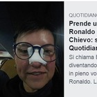 Cristiano Ronaldo la copisce con una pallonata, tifosa posta la foto con il cerotto