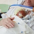 Il figlio nasce prematuro con una malformazione, la mamma tenta di ucciderlo con la candeggina