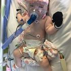 Coronavirus in ospedale dopo l'intervento a cuore aperto, bimba di 6 mesi attaccata al respiratore lotta per la vita
