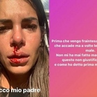 Giada Giovannelli sconvolta dopo l'aggressione: «Sono a pezzi, ho chiamato i carabinieri»