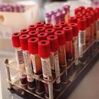 Tumori del sangue, 50 anni di Ail: oggi il 95% dei casi di leucemia fulminante guarisce