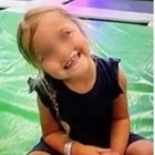 Aggredisce una donna a morsi, poi fugge con la figlia di 3 anni: la polizia dirama l'allerta