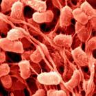 Serratia marcescens, il batterio killer resistente agli antibiotici