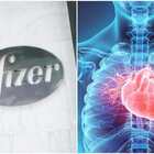 Effetti collaterali Pfizer, cos'è la miocardite 