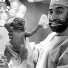 Bimbo appena nato toglie la mascherina al medico: lo scatto social della "speranza"