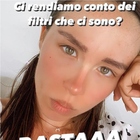 Aurora Ramazzotti su Instagram contro i filtri delle stories: «Basta, siamo meglio nature»