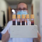 Virus, il virologo Silvestri: «Dal plasma convalescente buoni risultati. Covid19 in ritirata dall'Italia»