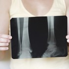 Osteoporosi, bere acqua mantiene le ossa forti. I consigli: sport e poco sale