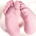 Lo strano caso dei geloni ai piedi nei bimbi. Pediatri: «Cento casi in 20 giorni, anomalo in primavera»