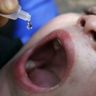 Polio: sintomi, vaccino, come si trasmette 