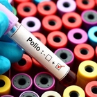 Polio, torna il virus in Gran Bretagna dopo venti anni: trovato nelle acque di scarico di Londra