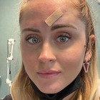 Valentina Ferragni operata al viso