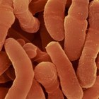 • "Scoperto un batterio resistente agli antibiotici"