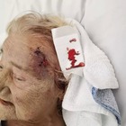 Russa troppo in ospedale: ricoverata uccisa a colpi di tazza da un'altra paziente