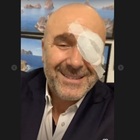 Il presidente scherza in video con l'occhio bendato: "Mi hanno picchiato". Poi deve spiegare che era solo una battuta