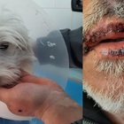 Turisti bergamaschi aggrediti da un pitbull in spiaggia: ferito l'uomo e il suo cagnolino. La coppia insultata dal padrone del molosso