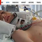 Scoppia una rissa a scuola, 13enne viene picchiato e finisce in coma