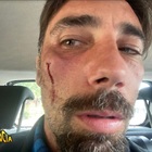 Vittorio Brumotti di Striscia La Notizia preso a pugni dai pusher di Foggia: «Non mi fermo»